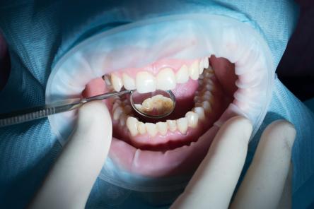 Лайфхак, который позволит бесплатно вылечить зубы в платной клинике