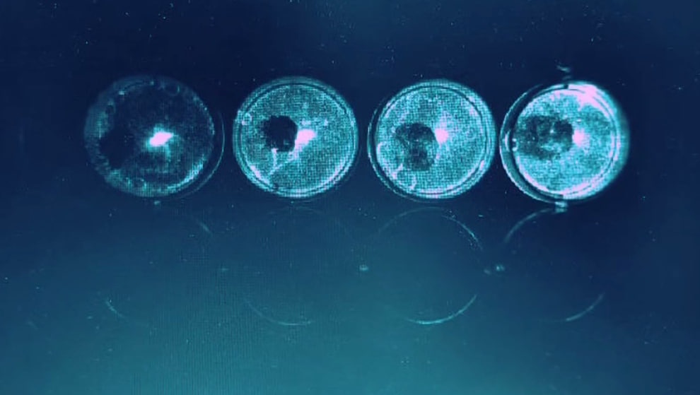 В Нижнем Новгороде разморозили 12-летние живые раковые клетки